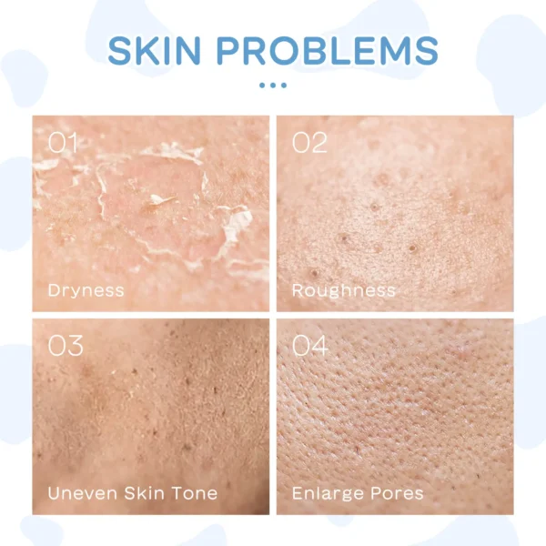 Laikou Radiant Refinement Milk Skincare Collection - Image 3