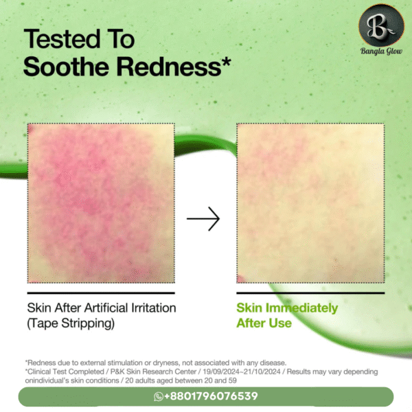 Anua Azelaic Acid 10% + Hyaluron Redness Soothing Serum