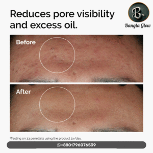 The Ordinary Niacinamide 10% + Zinc 1% Serum