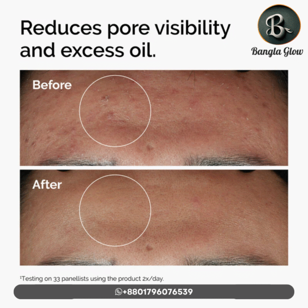 The Ordinary Niacinamide 10% + Zinc 1% Serum