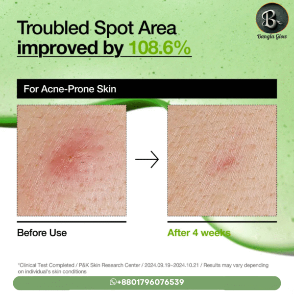 Anua Azelaic Acid 10% + Hyaluron Redness Soothing Serum