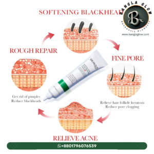 Bioaqua Salicylic Acid Ultimate Acne Removal Combo Set (Cleanser + Essence + Cream + Mask)