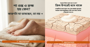 ফাটা গোড়ালির ক্লোজআপ ছবি