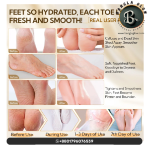 LANBENA Foot Peel Mask ব্যবহারের ফলাফল